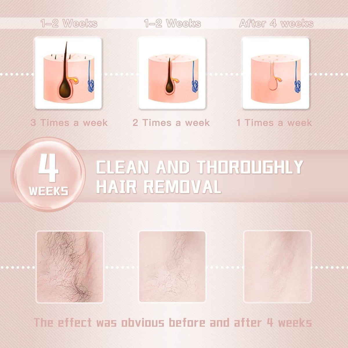 IPL Laser Hair Removal Device for Women and Men